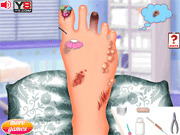 Игра Лечение ног